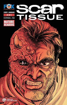 Scar Tissue Bargains #1